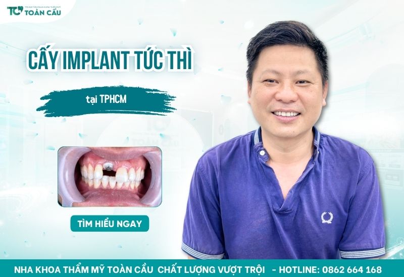 Cấy implant tức thì TPHCM ở đâu