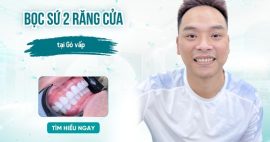 Tìm hiểu chi phí bọc sứ 2 răng cửa ở Gò Vấp