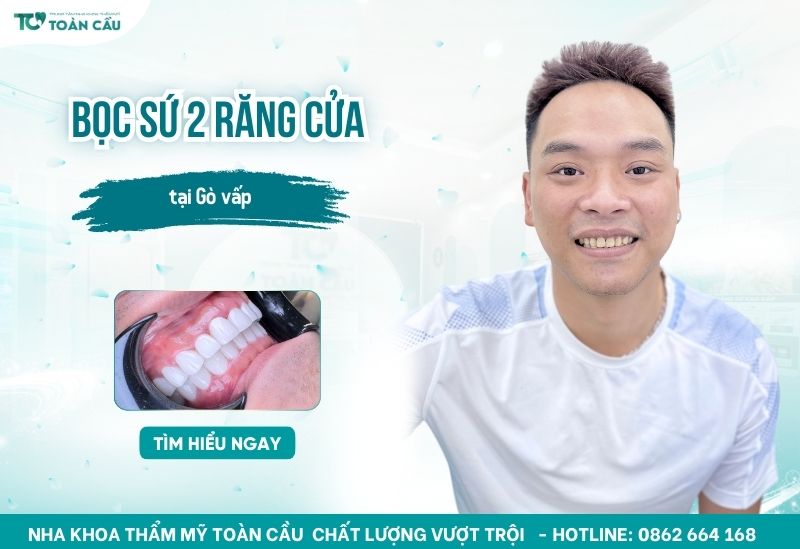 Tìm hiểu chi phí bọc sứ 2 răng cửa ở Gò Vấp