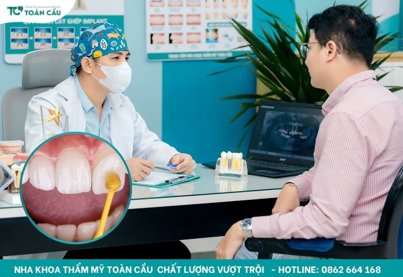 Chi phí bọc sứ 2 răng cửa ở Gò Vấp phụ thuộc vào nhiều yếu tố