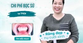 chi phí bọc sứ TPHCM