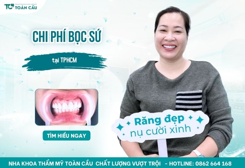 chi phí bọc sứ TPHCM