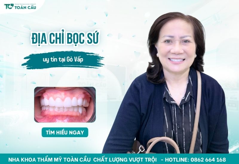 địa chỉ bọc sứ Gò Vấp