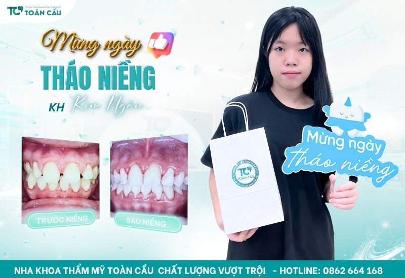 Khách hàng niềng răng mắc cài tại Toàn Cầu