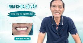 địa chỉ trồng răng cho người lớn tuổi