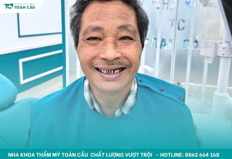 Địa chỉ trồng răng cho người lớn tuổi uy tín tại Gò Vấp 7 Việc trồng răng cho người lớn tuổi cần sự cẩn trọng hơn