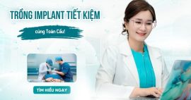 Giải pháp trồng răng implant tiết kiệm