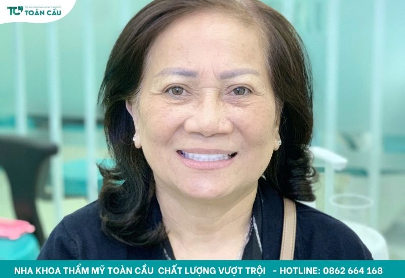 Làm răng sứ uy tín gần đây tại nha khoa uy tín TPHCM 5 Làm răng cải thiện thẩm mỹ nụ cười nhanh chóng