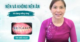 nên và không nên ăn khi đang niềng răng