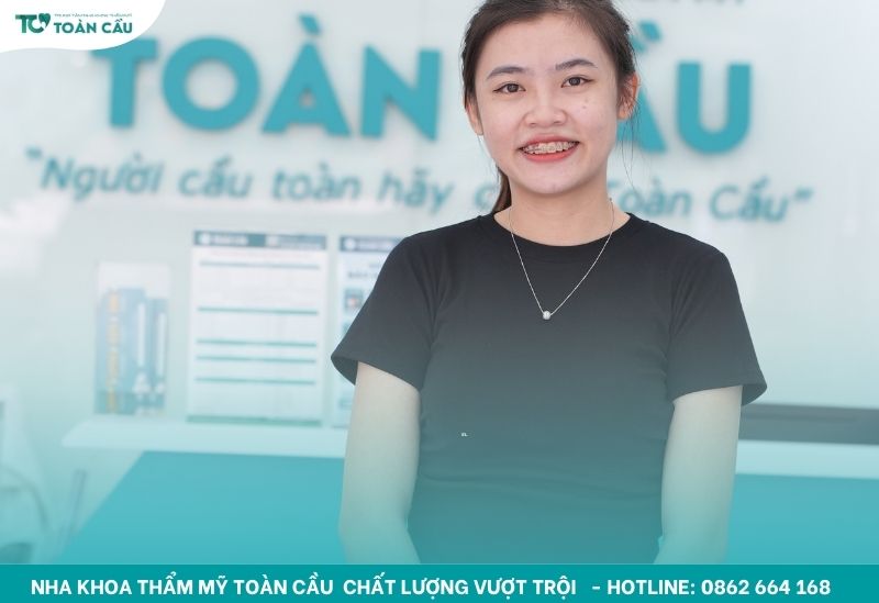 Những thực phẩm nên và không nên ăn khi đang niềng răng 5 Cần lưu ý về chế độ ăn uống khi niềng răng