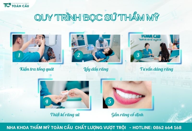 Địa chỉ nha khoa bọc sứ uy tín gần đây bạn nên biết 6 Tham khảo quy trình bọc sứ tại Toàn Cầu