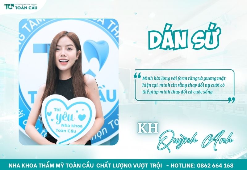 Review nha khoa dán sứ uy tín tại Gò Vấp đẹp tự nhiên 8 Khách hàng Quỳnh Anh dán sứ tại Toàn Cầu