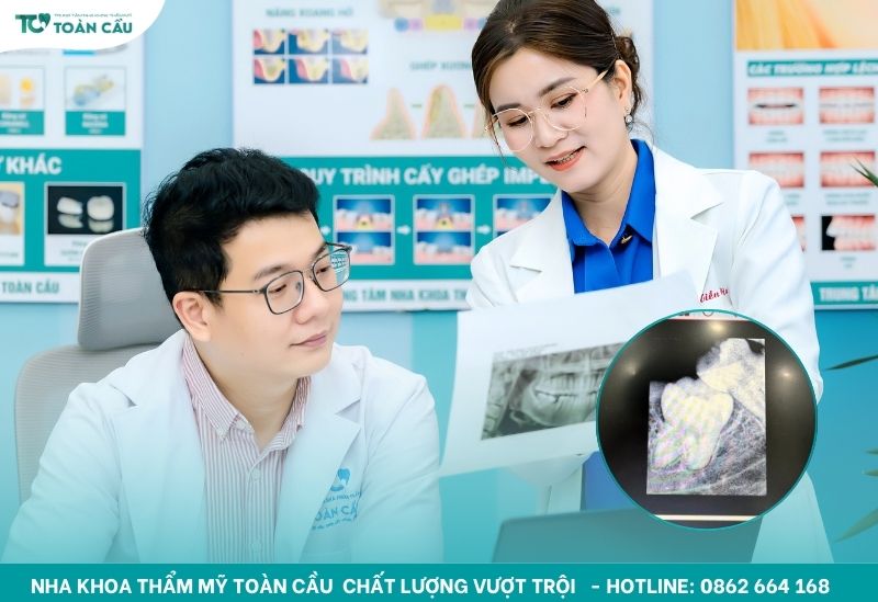Răng khôn thường mọc trong độ tuổi từ 17 đến 25