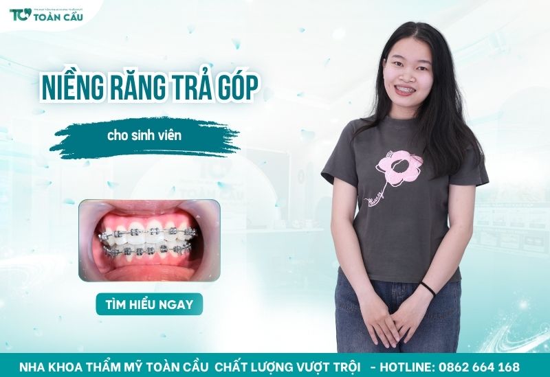 nha khoa niềng răng trả góp cho sinh viên