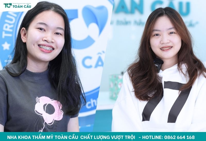 Nha khoa niềng răng trả góp cho sinh viên quận Gò Vấp 5 Nhu cầu tìm nha khoa niềng răng trả góp cho sinh viên ngày càng tăng