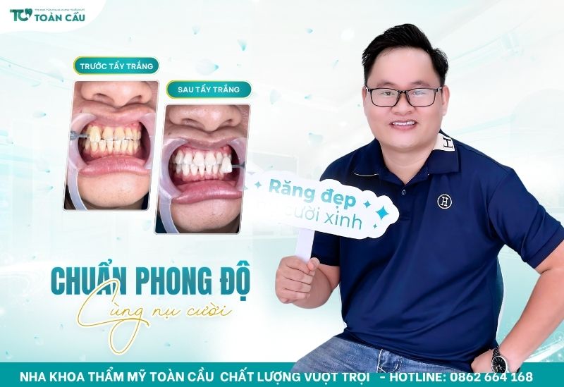 Nha khoa tẩy trắng răng bằng laser tại quận Gò Vấp 6 Phù hợp với người có răng bị ố vàng