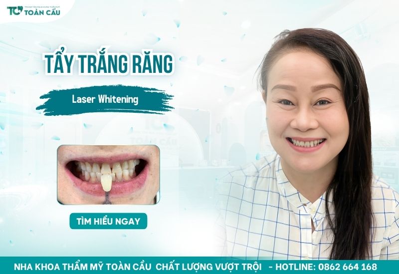 nha khoa tẩy trắng răng tại Gò Vấp