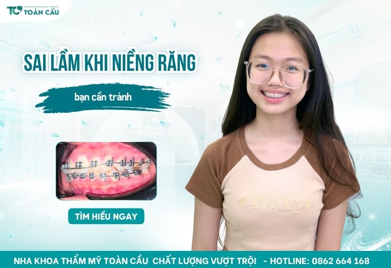 Những sai lầm khi niềng răng