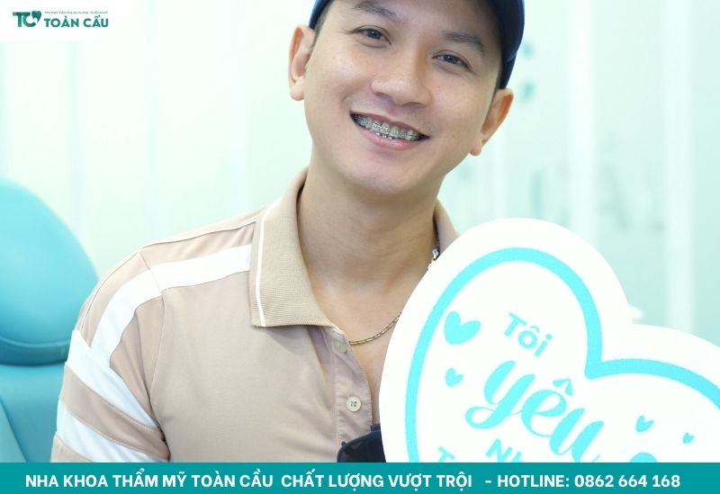 Những sai lầm khi niềng răng khiến thời gian kéo dài hơn bình thường 6 Cắn vật cứng là một trong những sai lầm khi niềng răng