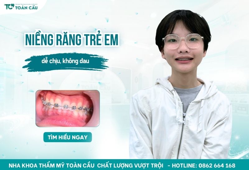 Niềng răng cho trẻ em tại Gò Vấp