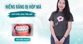 niềng răng có bị hóp má không