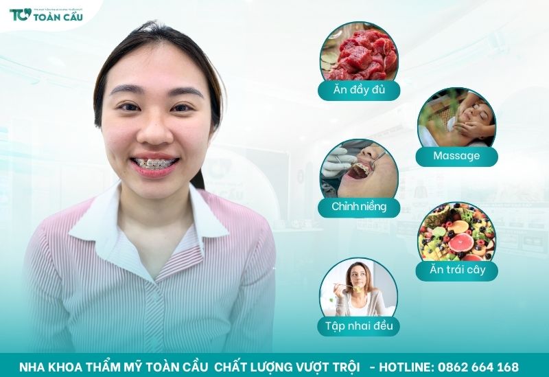 Niềng răng có bị hóp má không? Cách khắc phục hiệu quả 7 Cách khắc phục hiệu quả niềng răng bị hóp má