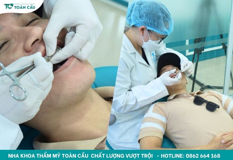 Niềng răng có bị hóp má không? Cách khắc phục hiệu quả 8 Địa chỉ niềng răng uy tín tại quận Gò Vấp