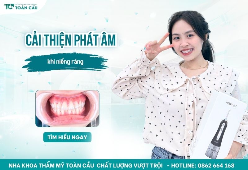 Niềng răng có giúp cải thiện phát âm