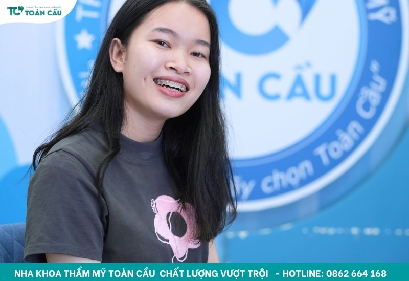 Niềng răng có giúp cải thiện phát âm không? Câu trả lời từ chuyên gia 5 Giải đáp niềng răng có giúp cải thiện phát âm không