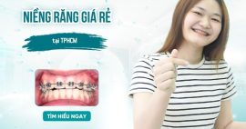 niềng răng giá rẻ gần nhất