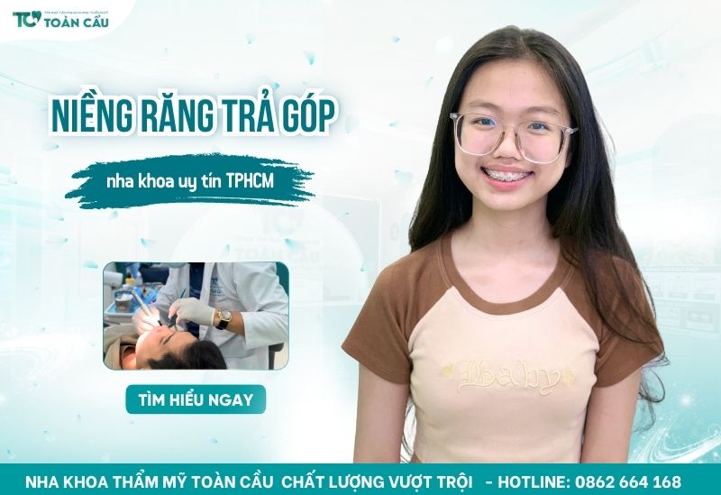 Niềng răng trả góp TPHCM ở đâu