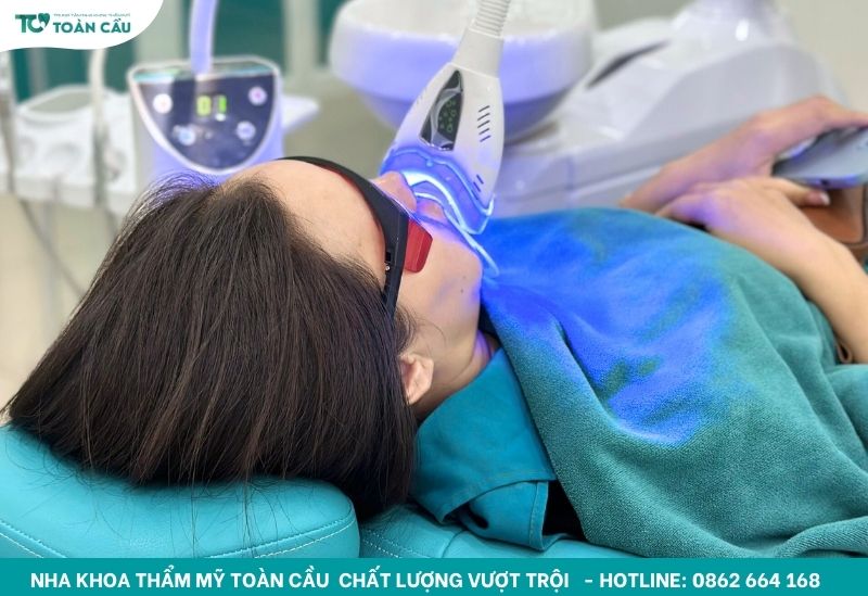 Tẩy trắng răng tại nha khoa bằng laser