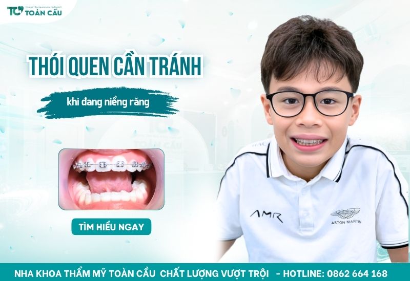thói quen xấu cần tránh khi niềng