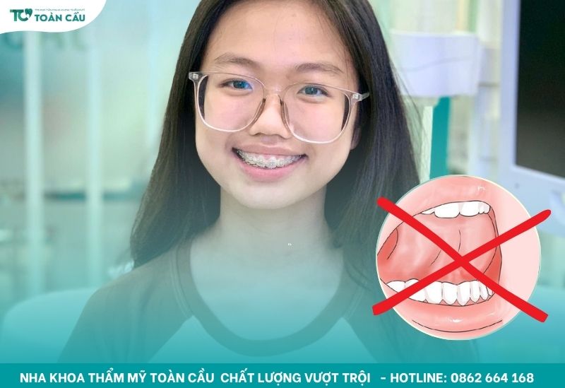 Những thói quen xấu cần tránh khi niềng răng để không làm lệch mắc cài 6 Không nên đẩy lưỡi, mút môi hoặc cắn má trong