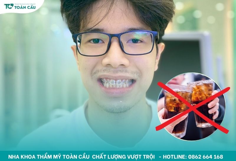Những thói quen xấu cần tránh khi niềng răng để không làm lệch mắc cài 7 Hạn chế uống nhiều nước có gas và thực phẩm có màu