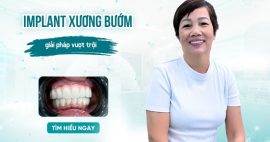 trồng implant xương bướm uy tín ở Gò Vấp