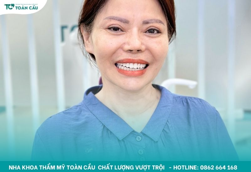 Trồng implant xương bướm uy tín ở Gò Vấp có đắt không? 7 Cảm giác ăn nhai giống như răng thật