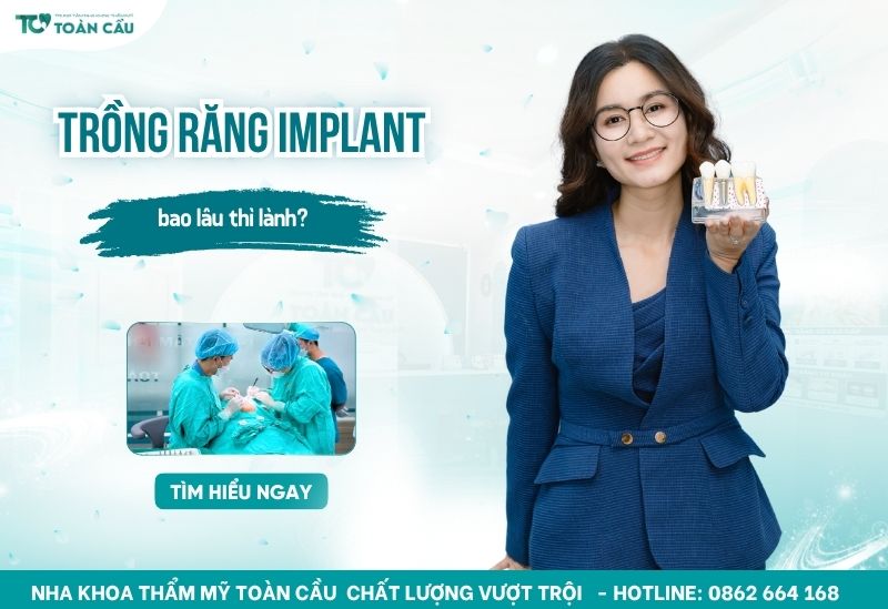 trồng răng implant bao lâu thì lành
