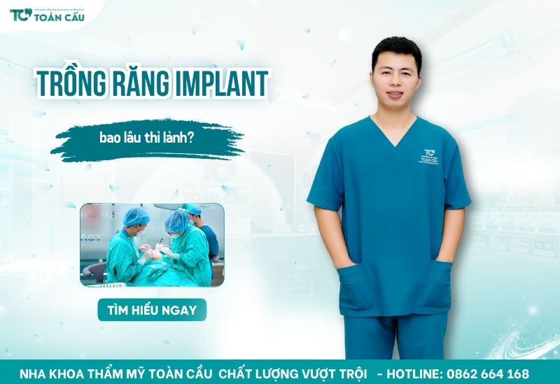 trồng răng implant bao lâu thì lành