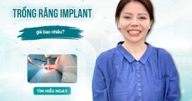 trồng răng Implant giá bao nhiêu