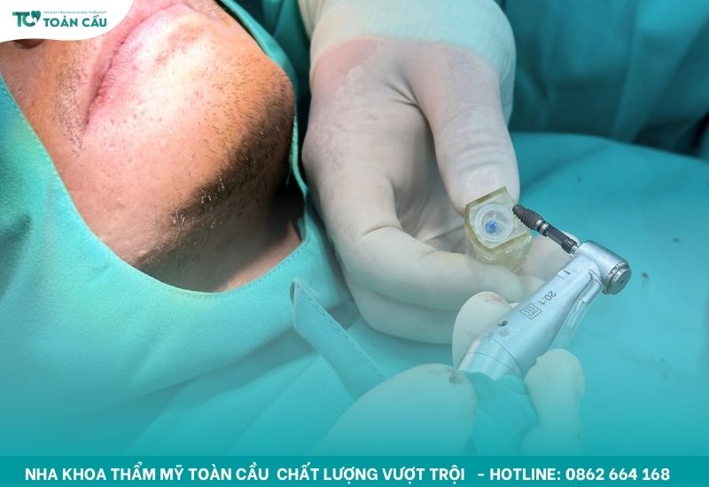 Trồng răng implant toàn hàm All-on-6 ở địa chỉ nào uy tín? 6 Không phải nha khoa nào cũng có thể cấy implant All-on-6