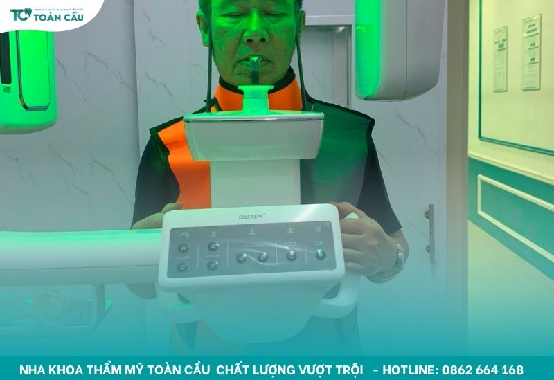 Trồng răng implant toàn hàm All-on-6 ở địa chỉ nào uy tín? 8 Nha khoa lắp đặt máy chụp X-quang CT Conebeam 3D