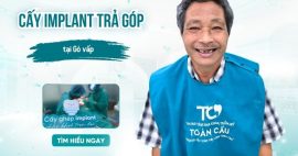 trồng răng Implant trả góp