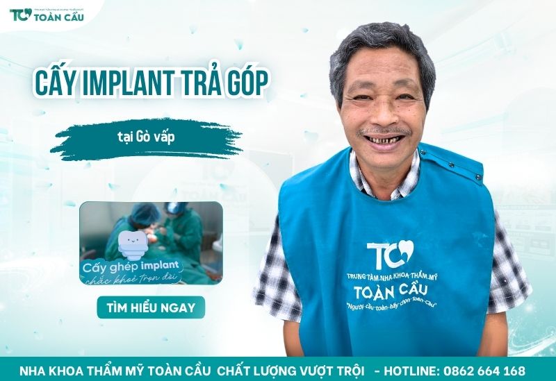 trồng răng Implant trả góp