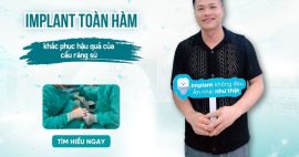 cầu răng sứ dẫn đến implant toàn hàm
