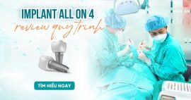 Cấy implant All on 4 không đau Gò Vấp