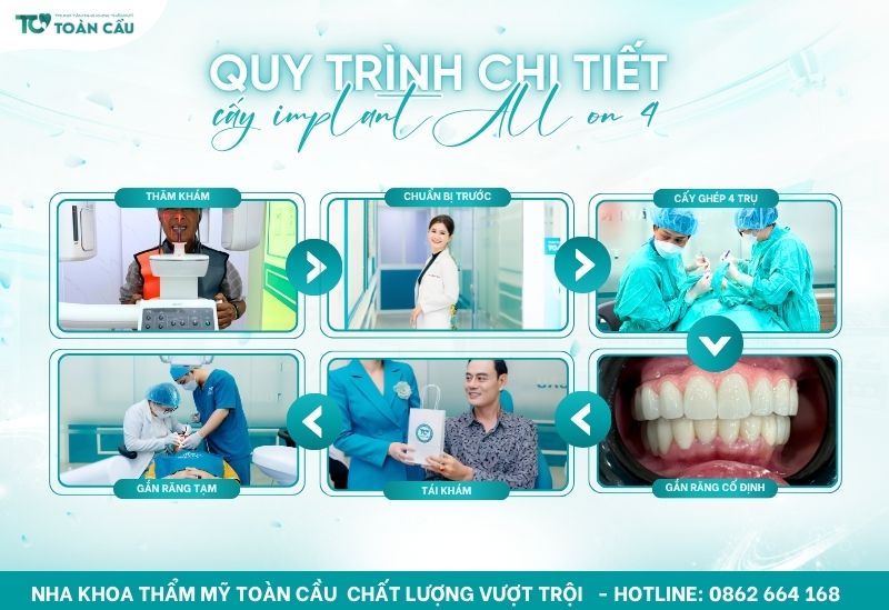 Quy trình chi tiết tại Nha Khoa Thẩm Mỹ Toàn Cầu