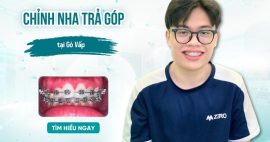 Chỉnh nha trả góp tại Gò Vấp