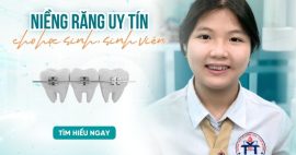 Địa chỉ niềng răng uy tín TPHCM