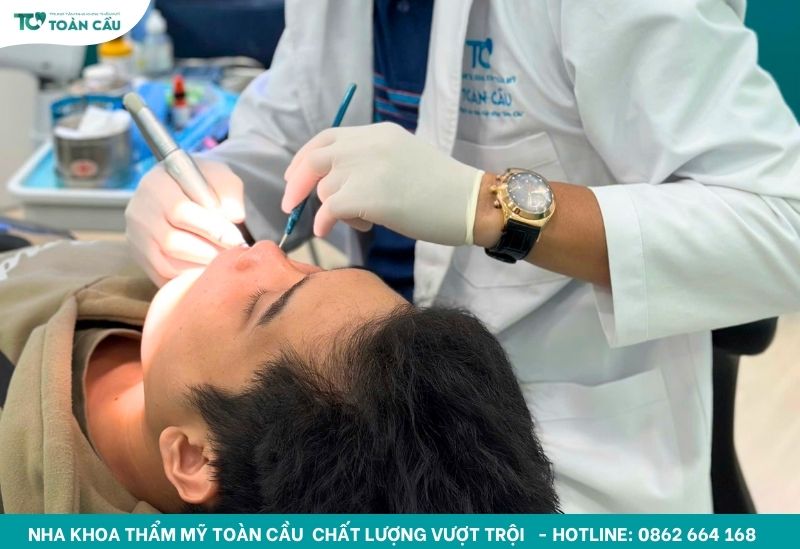 Địa chỉ niềng răng uy tín TPHCM cho học sinh, sinh viên 9 Thời gian niềng răng kéo dài 18 - 24 tháng